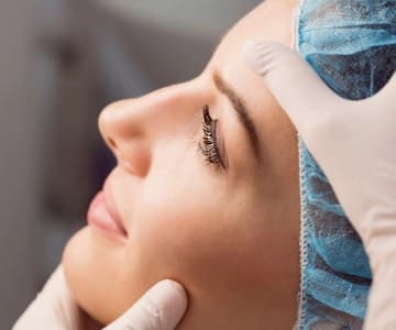 Septumplastia