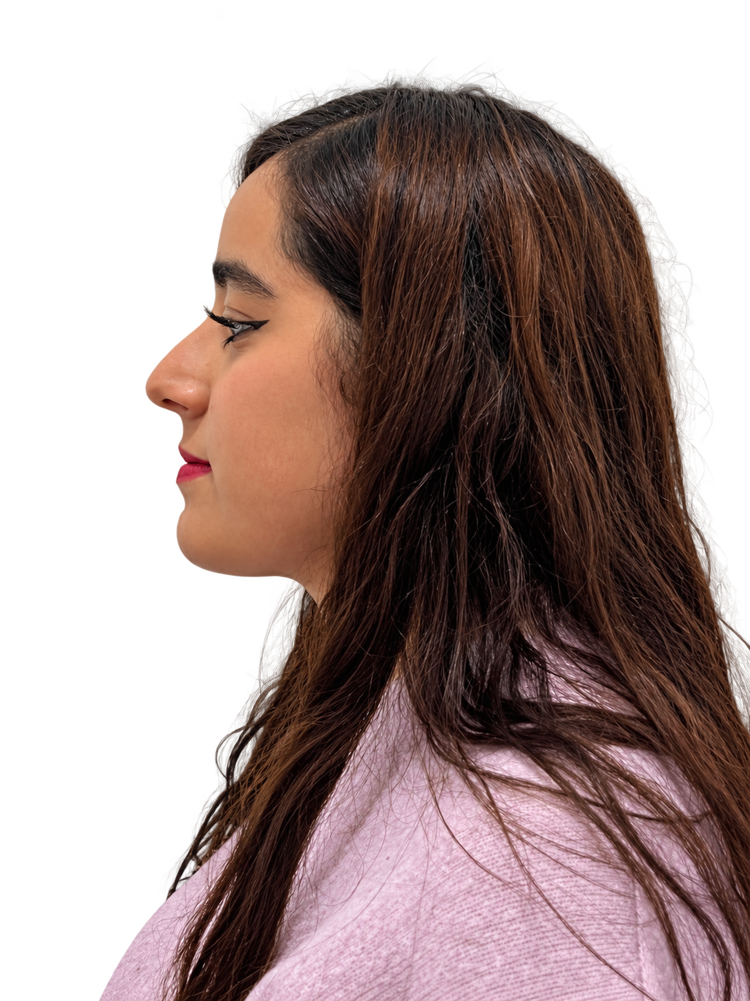 Caso 7, fotografía 1